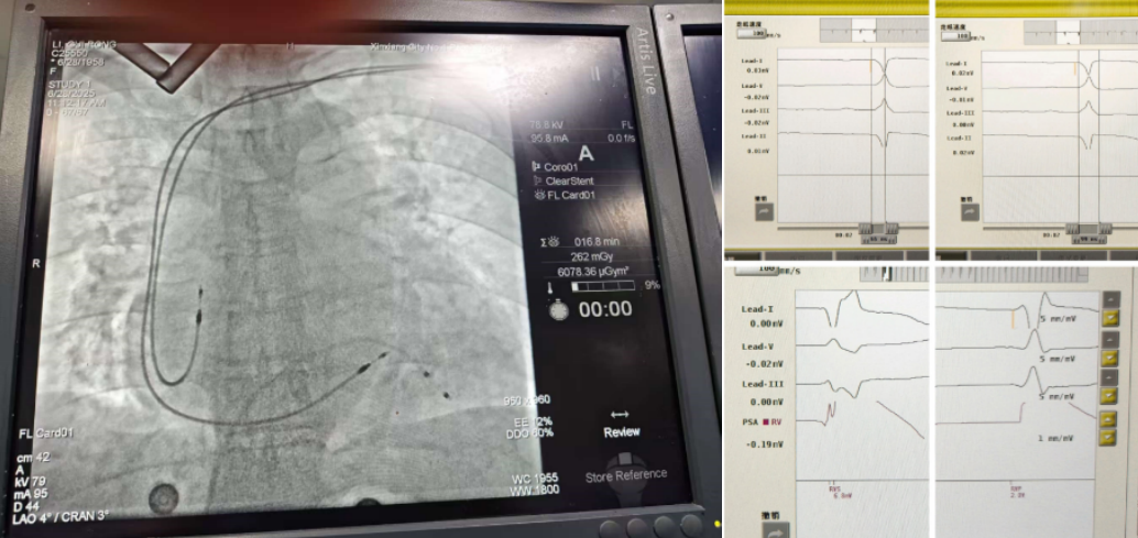 QQ20250701-105331.jpg QQ20250701-105331.jpg